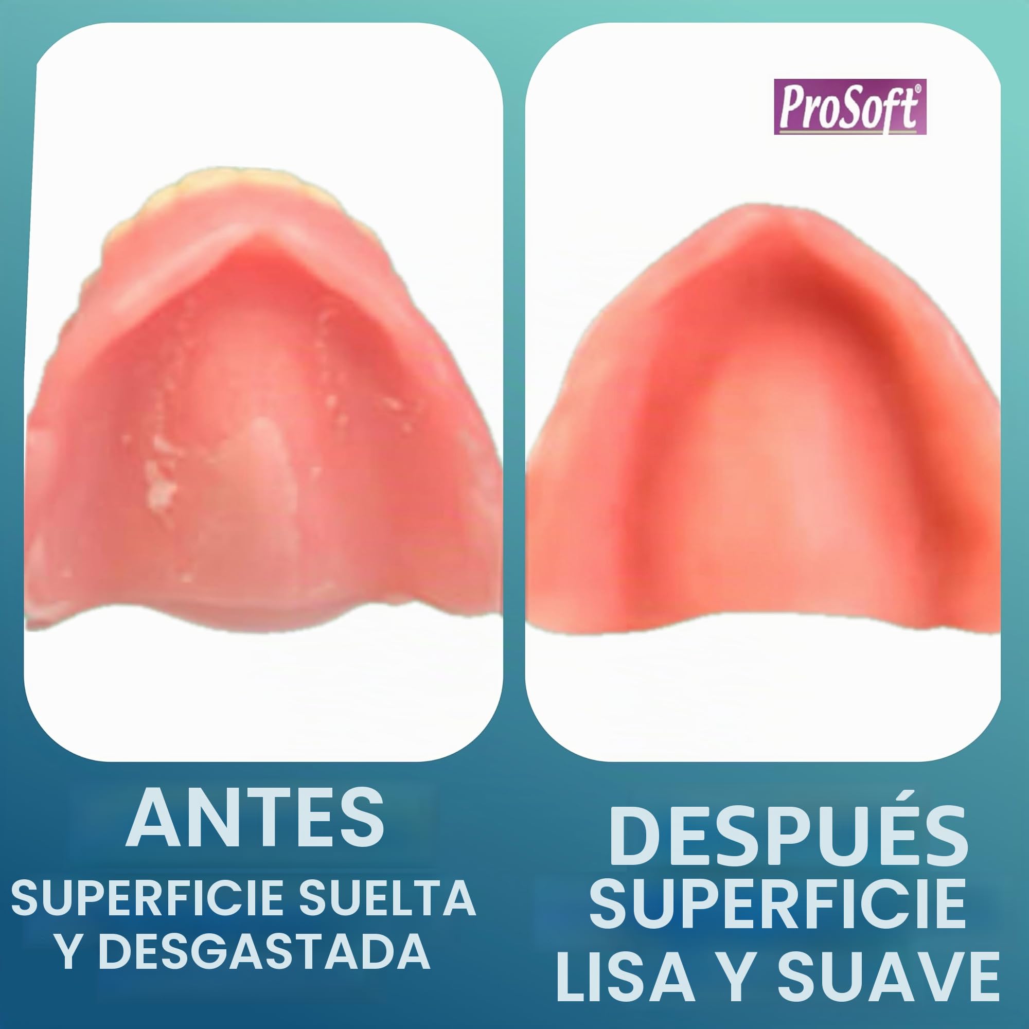 ProSoft - Reliner de prótesis dental, 2 placas de prótesis