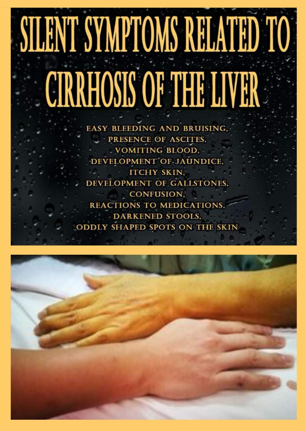 Buy Silent Symptoms Related to Cirrhosis of the Liver Easy bleeding