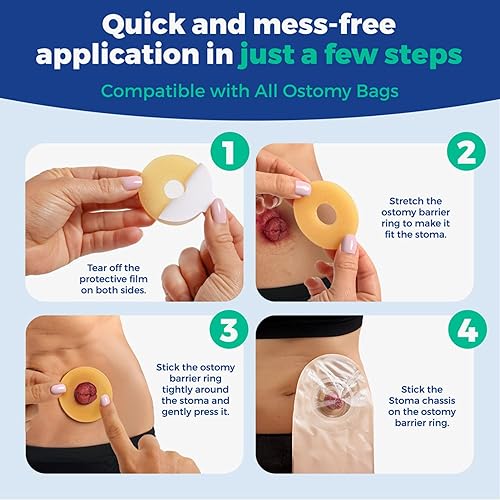 Miniatura 5 de Anillos de barrera para ostomía elegibles para FSA y HSA, 10 anillos de estoma de 0.157 pulgadas de grosor, suministros de colostomía para