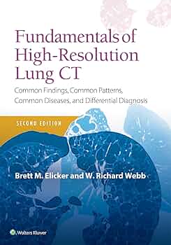Fundamentals of High-Resolution Lung CT: Common Findings, Common