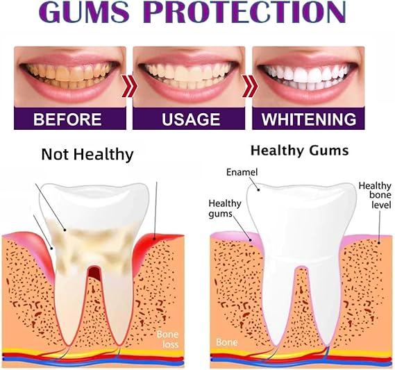 Purple Teeth Whitening Strips Kit, 14PCS Teeth Whitening Strips for White Teeth, Easy to Use & Effective Stain Removal, 30 Minute Fast Color Correction, Safe & Non-Slip Whitening Strips