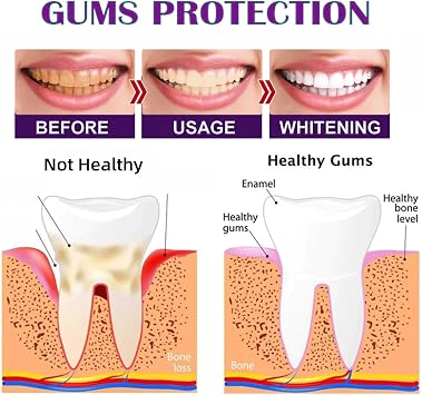 Purple Teeth Whitening Strips Kit, 14PCS Teeth Whitening Strips for White Teeth, Easy to Use & Effective Stain Removal, 30 Minute Fast Color Correction, Safe & Non-Slip Whitening Strips