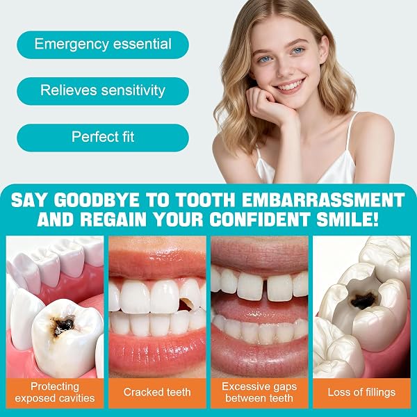 Otturazione Dentale Provvisoria, Cemento Dentale Definitivo Per Otturare Cavità, Formula Delicata, Adatto per Riparazioni di Emergenza, Garantisce Un'adesione Forte, 15g - 3
