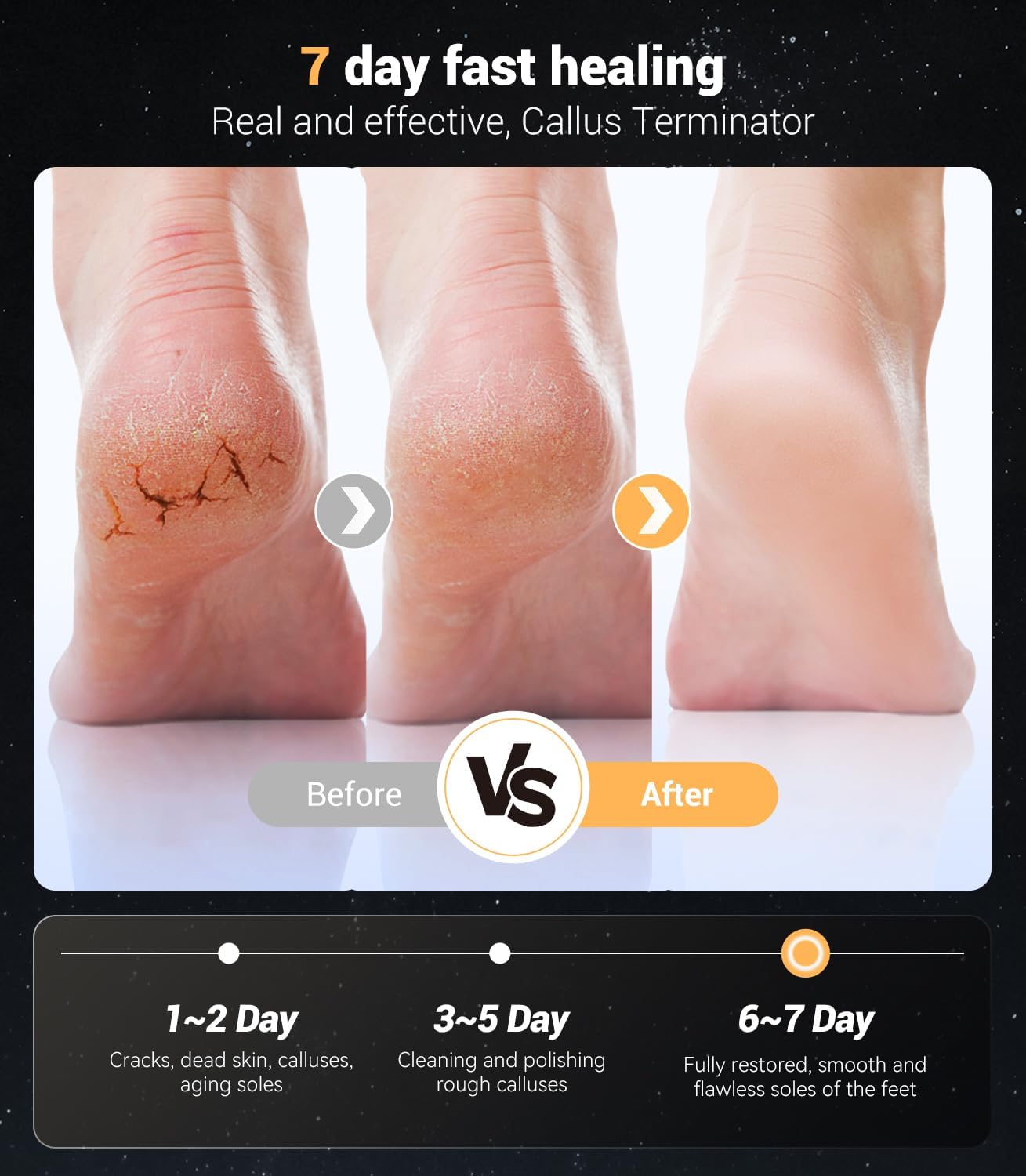 Electric Foot Callus Remover,Rechargeable Electric Callus Remover for Feet【Variable 3-Speed & LED Light】【Removes 99.92% of Calluses】 Portable Foot File Pedicure Kits with 30 Grit Pads-Silver