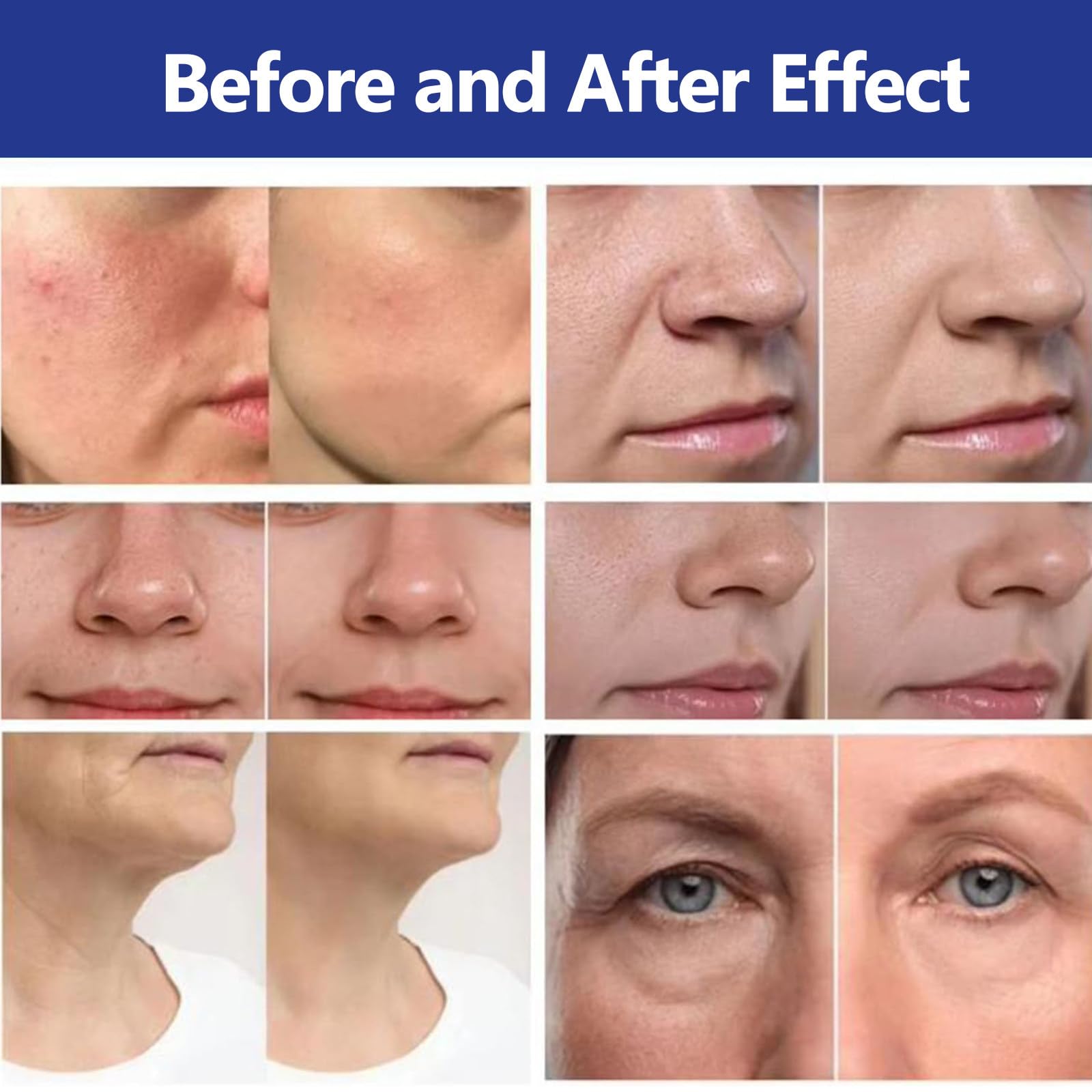 14 en 1 Máquina de Belleza | Hidrofacial Profesional | Limpieza Facial Profunda & Reafirmación | Hidropeeling, Microdermoabrasión y Oxigenoterapia | para SPA,Salón y Uso en Casa
