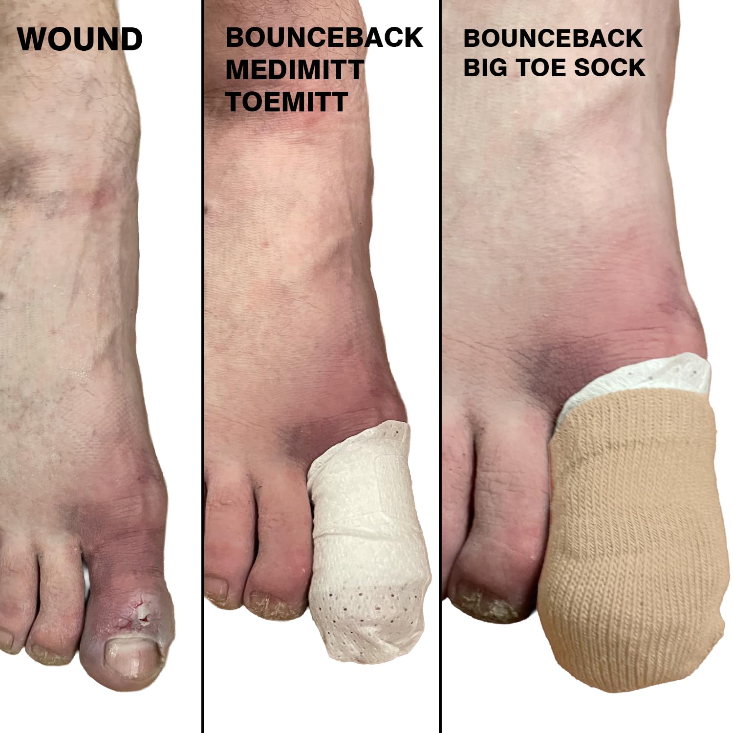 BOUNCEBACK Calcetines de punta grande para niños y adultos, calcetines de algodón con agarre de silicona antideslizante en el borde del puño interior, uñas de los pies, Desnudo/, Large/X-Large