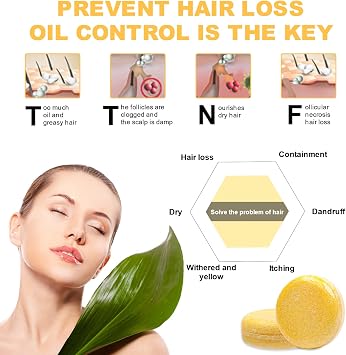 Ginger Hair Regrowth Shampoo Bar, Anti Hair Loss Ginger Shampoo Soap, Promotes Hair Growth, Hair Growth Repair (1PC)