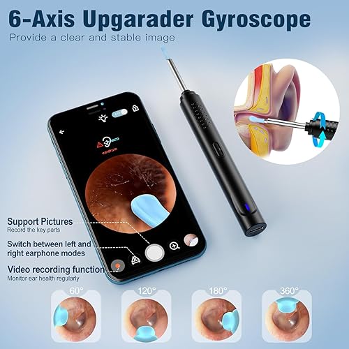 Miniatura 4 de vasdaren Eliminación de cera de oídos, limpiador de oídos con cámara con 1296P, kit de eliminación de cera de oídos con 9 juegos de orejas y 8