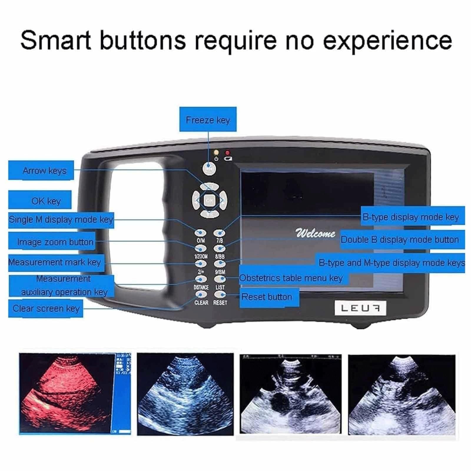 WYWY Zestaw weterynaryjnego skanera ultrasonograficznego – przenośna maszyna do testowania ciążowego HD z sondą mechaniczną dla świń i owiec – idealna do testowania ciążowego na zwierzętach