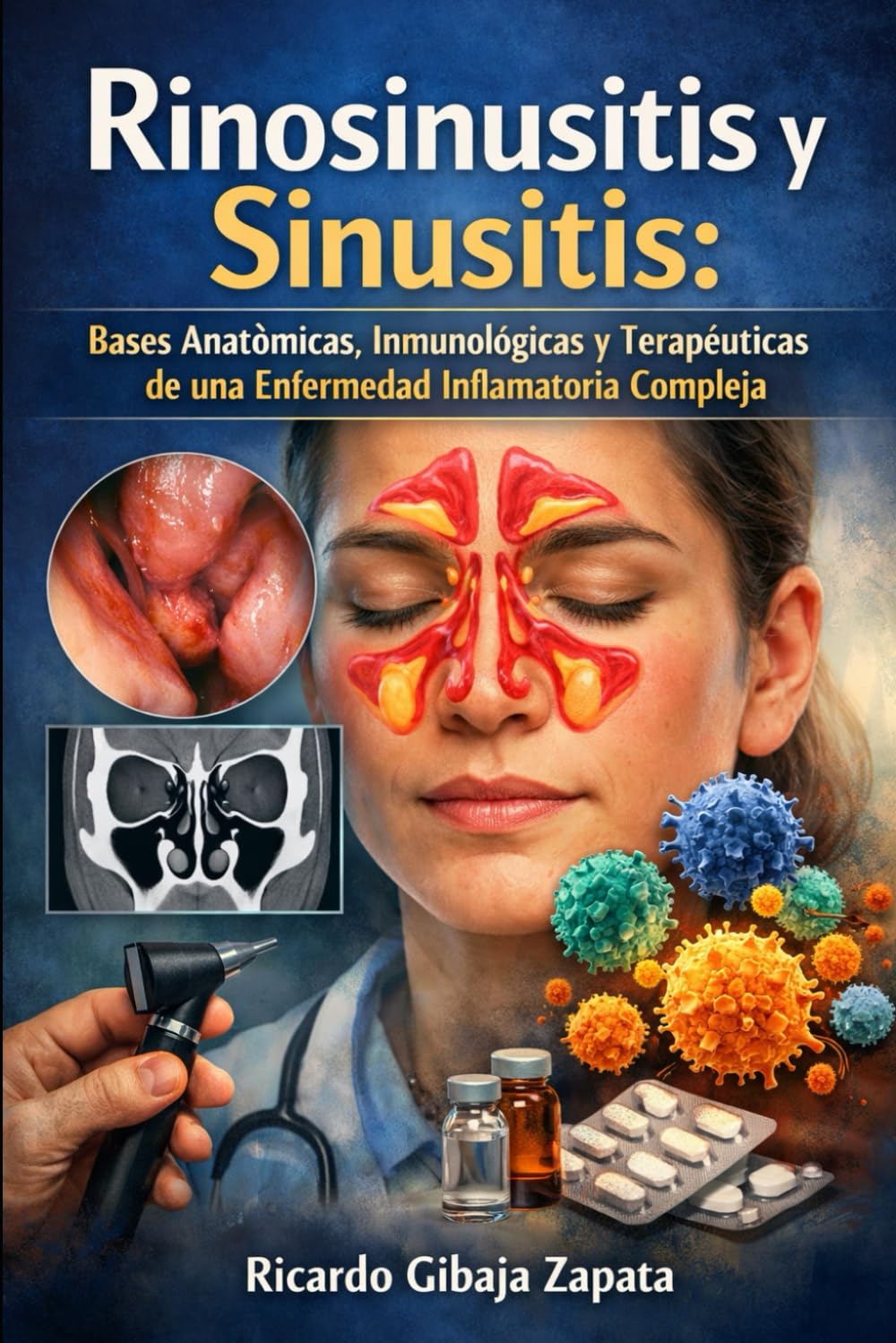 Sinusitis y rinosinusitis: bases históricas, fisiopatológicas, diagnósticas y terapéuticas