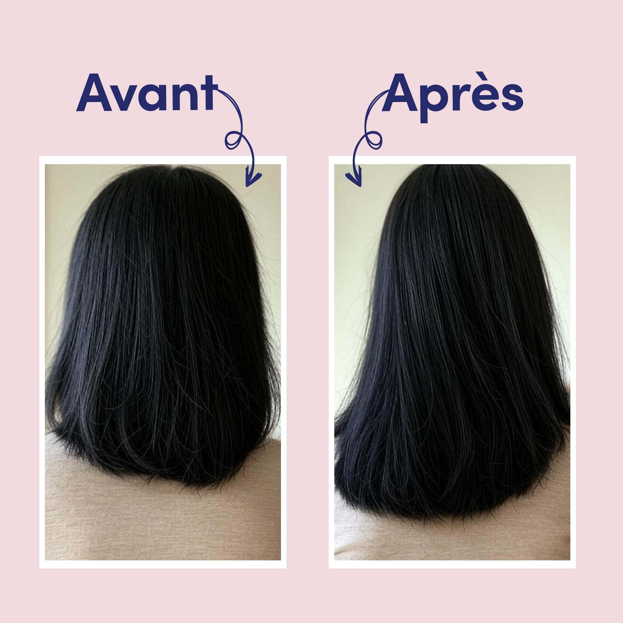 MYRIAM K PARIS – Sérum Pousse Cheveux 140ml – Scalp – Stimule la Croissance & Réduit la Chute – Complexe Actif aux 9 Plantes & Procapil – Pour Cheveux Clairsemés ou Affinés