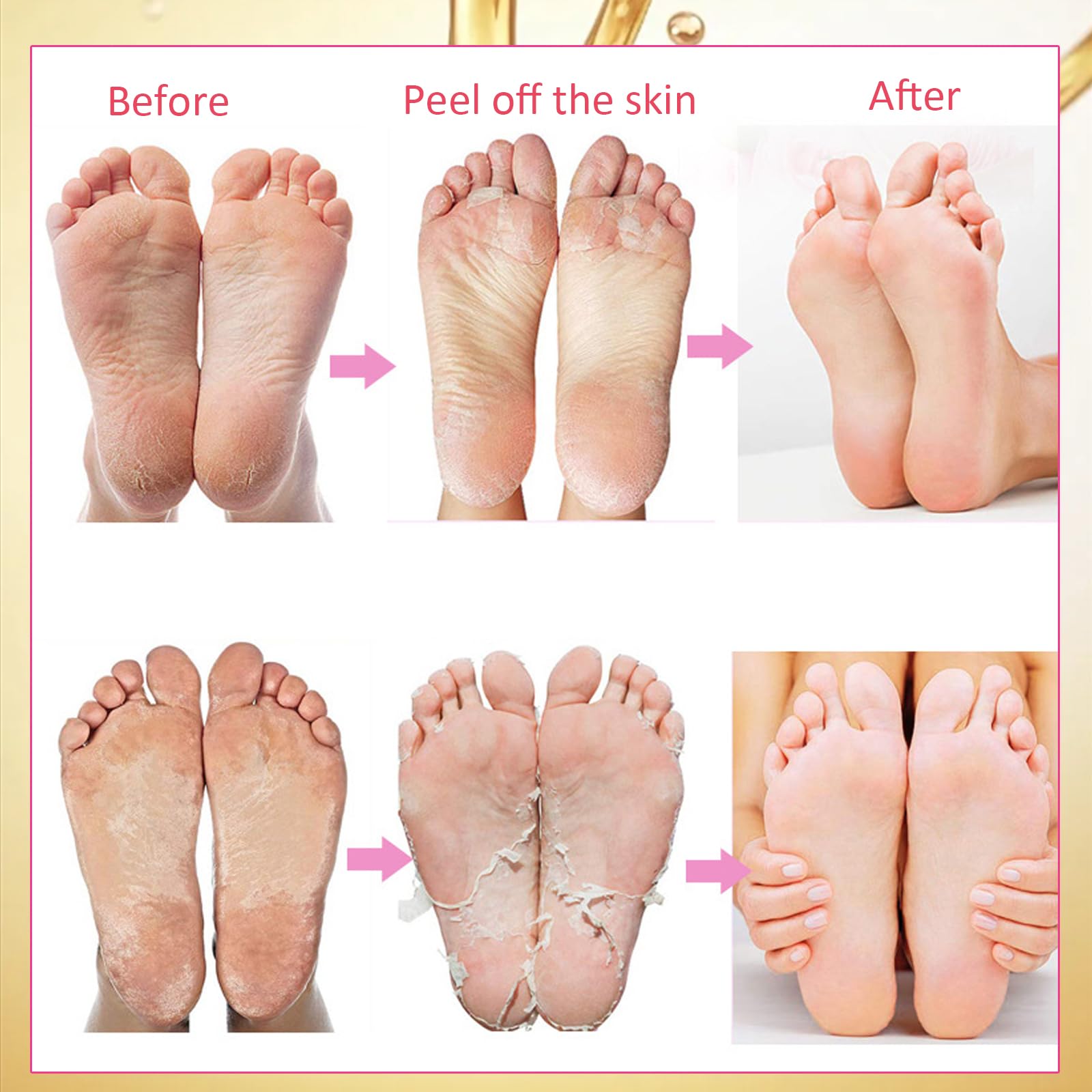 Maschere Idratanti per Piedi, 7 Paia Maschera Idratante per la Cura dei Piedi, Maschera Piedi Peeling Esfoliante, Maschera Idratante per Peeling Piedi, Calzini Esfolianti per Piedi per Donne Uomini