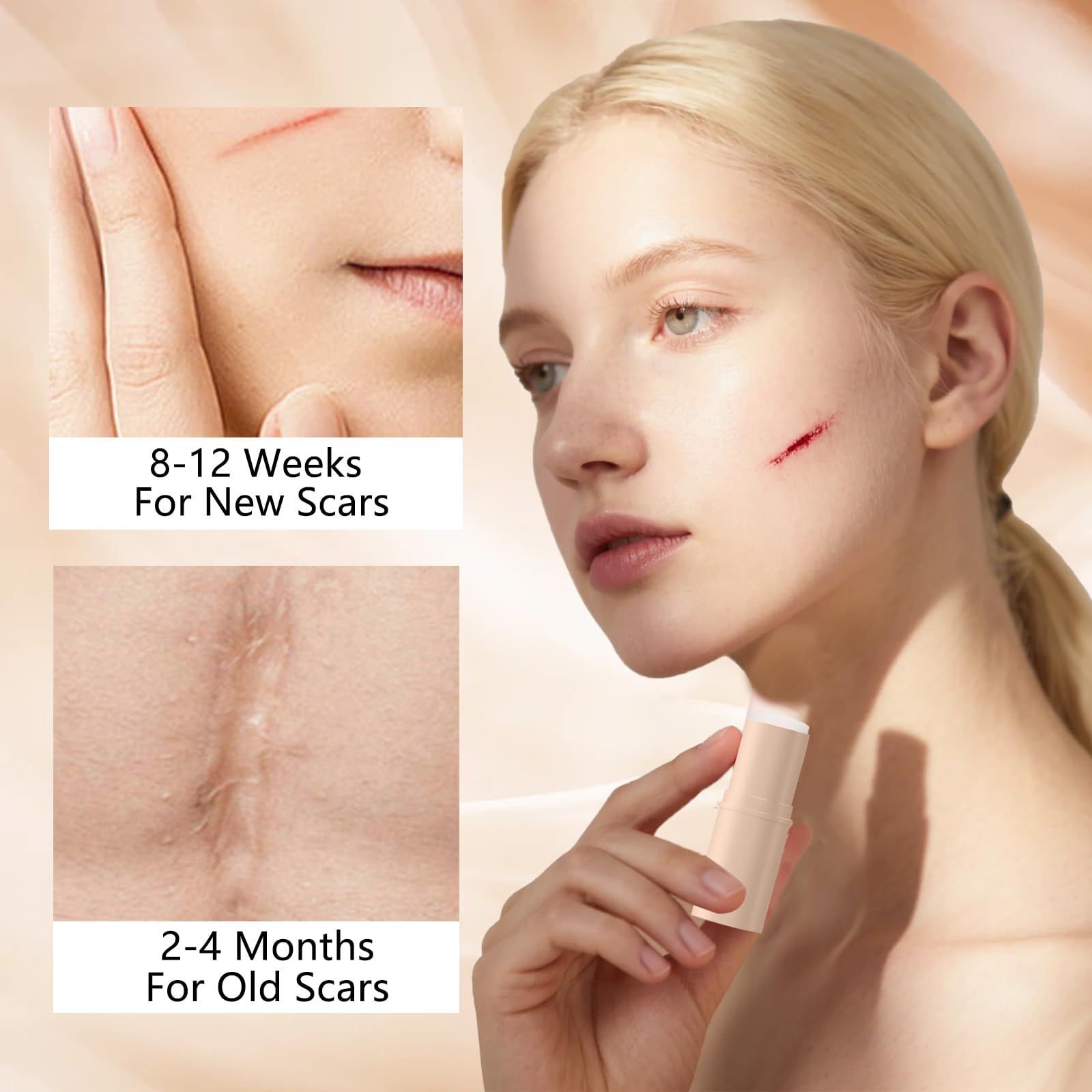 Scar Solutions - Stick per cicatrici in silicone, realizzato in 60% silicone, leggero e facile da applicare, delicato su tutti i tipi di pelle (2 pezzi)