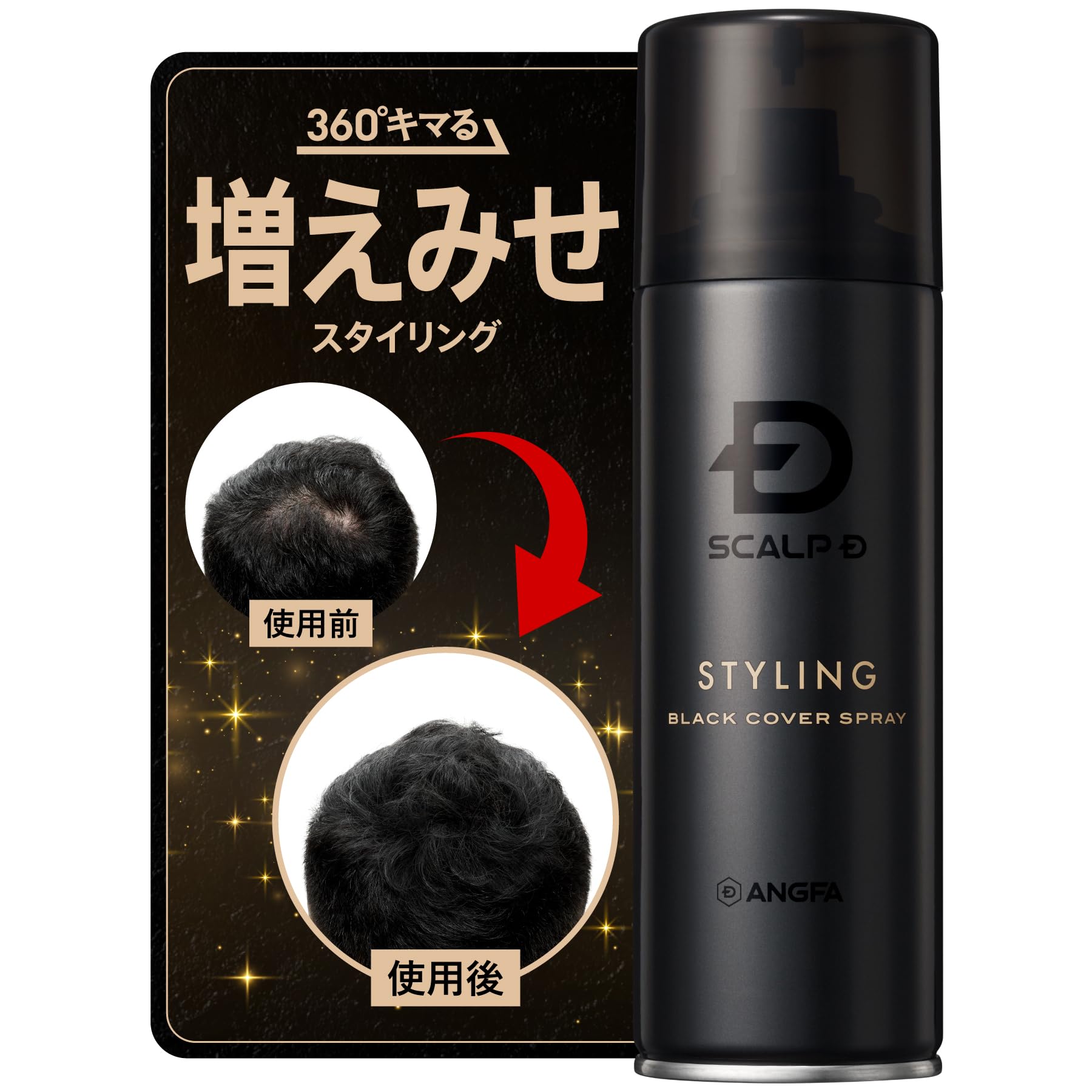アンファー スカルプD ブラックカバースプレー 150g 4個セット Amazon | アンファー (ANGFA) スカルプD ブラックカバースプレー 150g