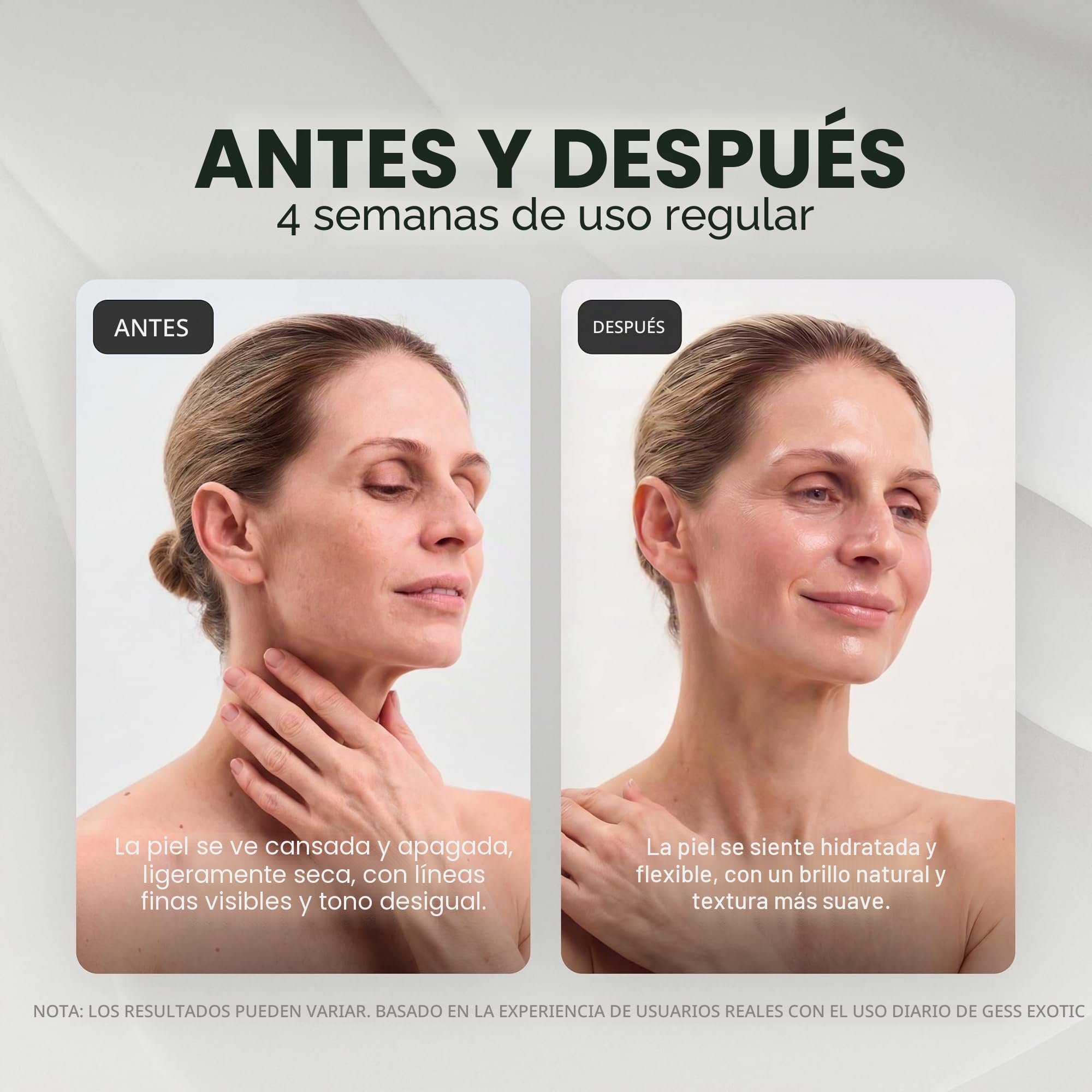 GESS Exotic - Original - Exfoliante ultrasónico para limpieza facial, 5 modos, limpiador de poros, exfoliante ultrasónico, antiedad, eliminador de puntos negros, estiramiento facial - amarillo