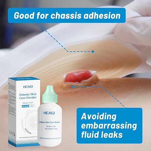 Miniatura 7 de Polvo de estoma heagied, suministros de polvo de ostomía de protección de barrera cutánea, polvo adhesivo para estoma, polvo para el cuidado de la