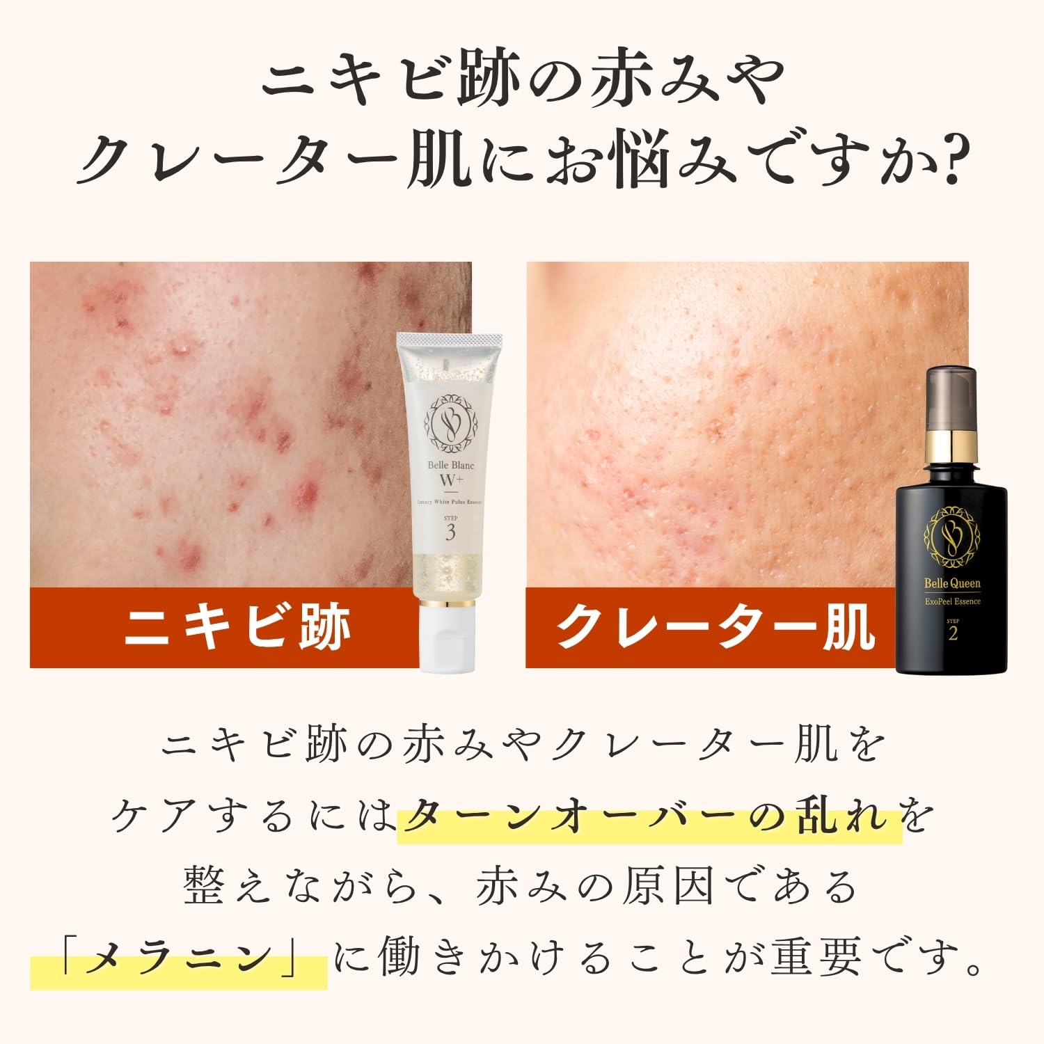 ドクターRe9　Belle Queen ExoPeel Essence Amazon.co.jp: Dr. Re9 [Medicinal] Acne Scars Dedicated Belblanc W+