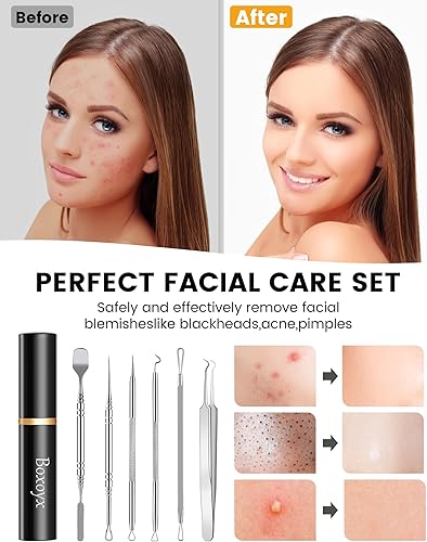 Miniatura 6 de Kit de herramientas para reventar espinillas, kit de 6 piezas de extracción de puntos negros, kit extractor de comedones con caja para eliminación