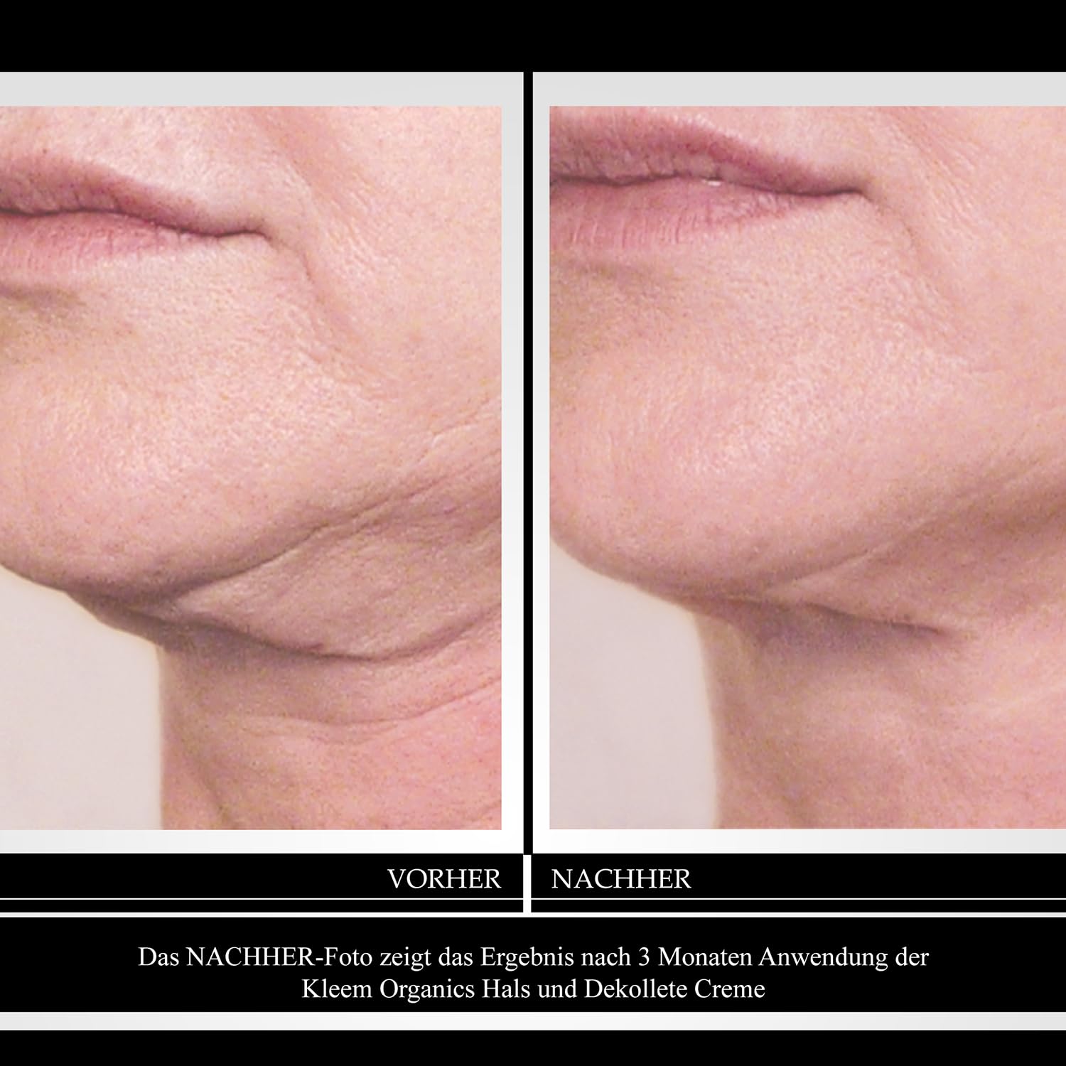 Hals und Dekollete Creme mit Peptiden und Retinol - Neck Firming Cream zur Reduzierung von Falten, Halslinien und Schlaffer Haut - Natürliche Firming Neck Cream für Glatte und Jugendliche Haut - 50 ml