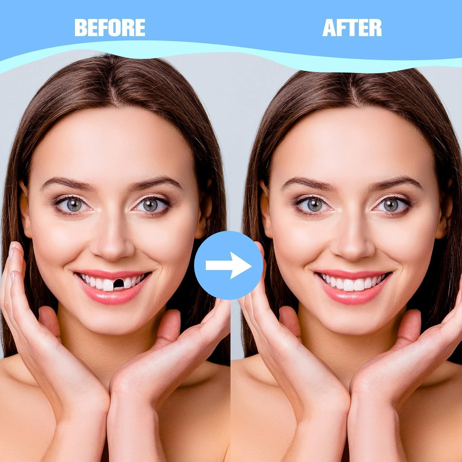 Treela 200 Pcs Fake Teeth for Missing Teeth Replacement Repair Kit Tooth Veneer Crown Replacement it Yourself Front Dental Veneer with Thermal Beads for Holiday Cosplay