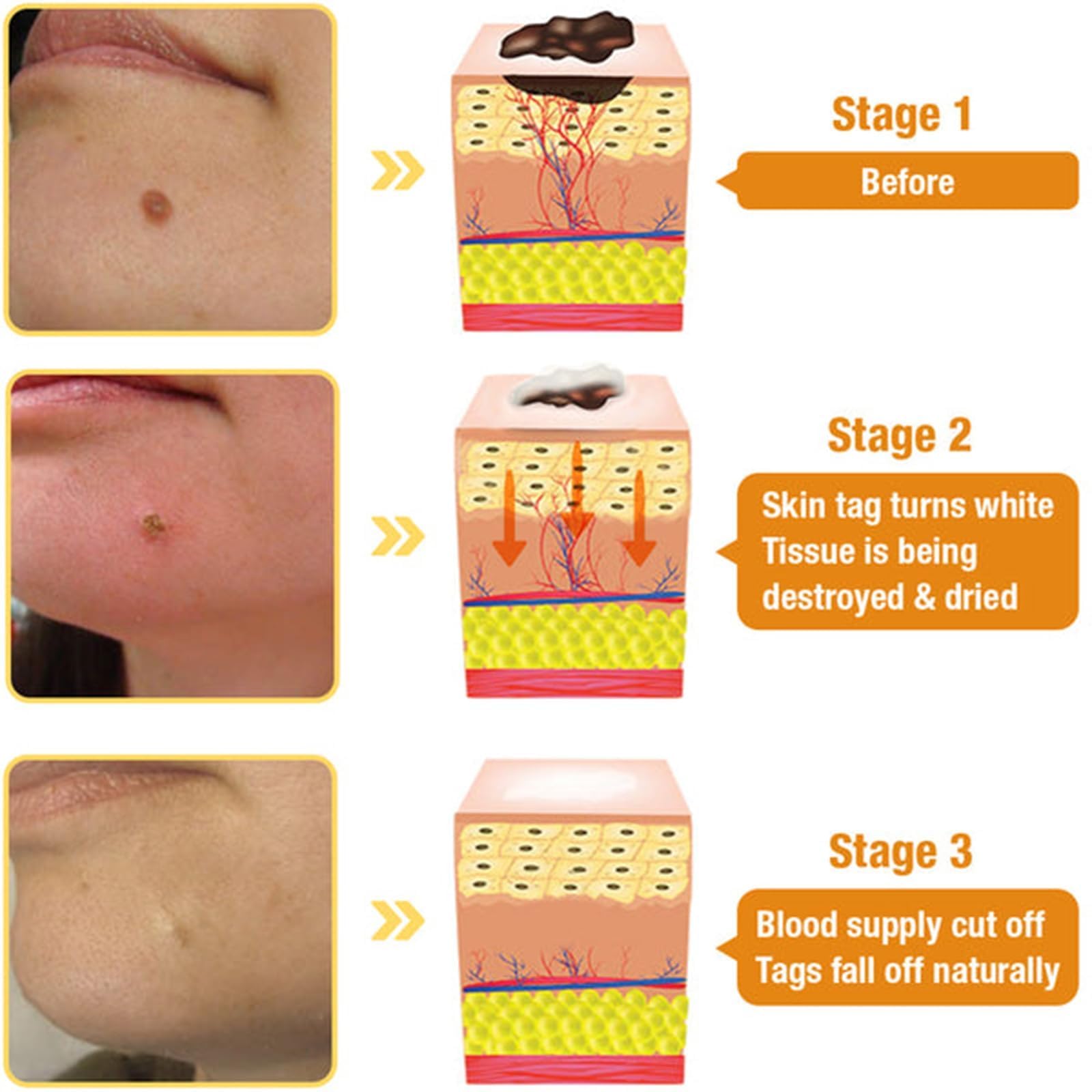 DEJIN 2 Pcs Bee Venom Skin Treatment Cream, Professional Repair and Moisturizing Gel, Hydrating New Formula for All Skin Types - Image 2