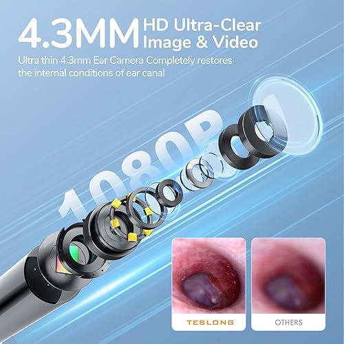 Miniatura 2 de Teslong Teslong - Otoscopio digital con removedor de cera de oído, cámara de oído con herramientas de eliminación de cera de oído, otoscopio de