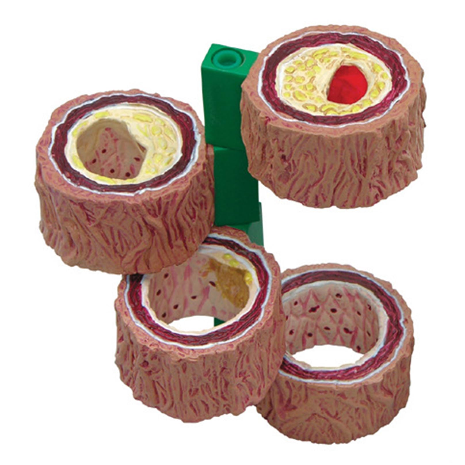 Modèle d'artère en 4 pièces, réplique de l'anatomie du corps humain de la plaque de l'artère accumule pour outil éducatif de bureau, modèle d'apprentissage médical e A