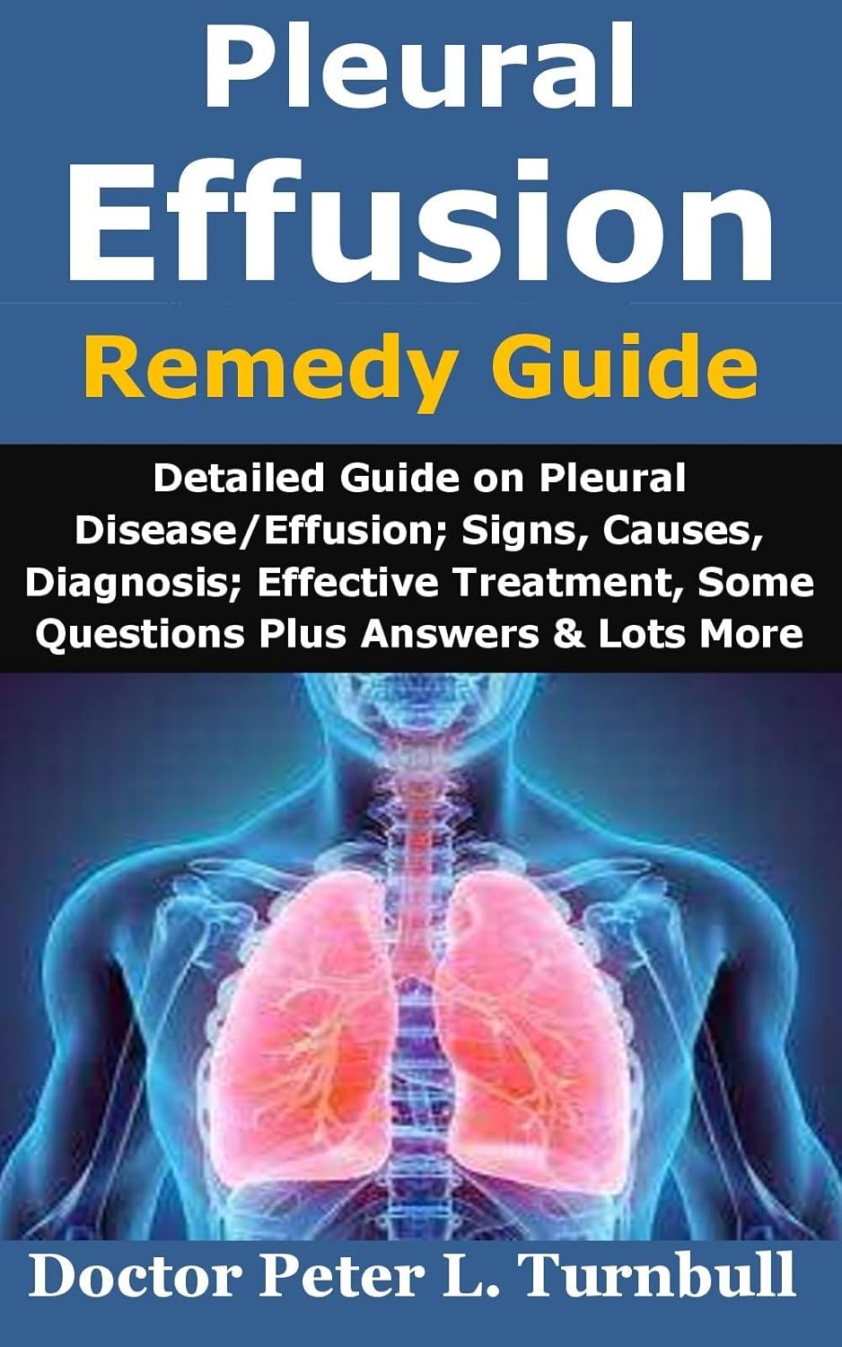 Pleural Effusion Remedy Guide Detailed Guide on Pleural Disease/Effusion; Signs, Causes