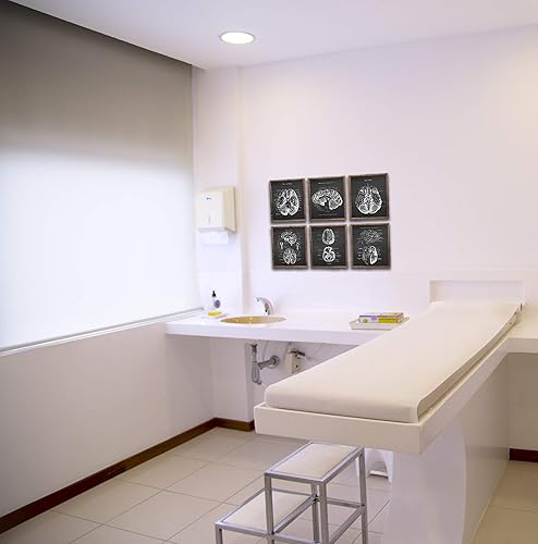 Miniatura 3 de Gnosis Picture Archive Neuroscience Art set de 6 impresiones sin marco de anatomía del cerebro humano