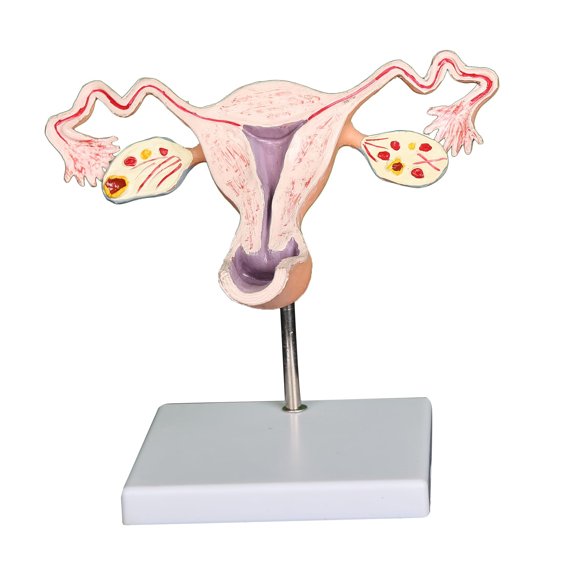 Kay Kay Industries Advance Female Uterus model and Ovary Anatomy Highly Deatiled and Accurate | Perfect Gynecology Tool for Medical Professionals (B096N7391C) Amazon Price History, Amazon Price Tracker