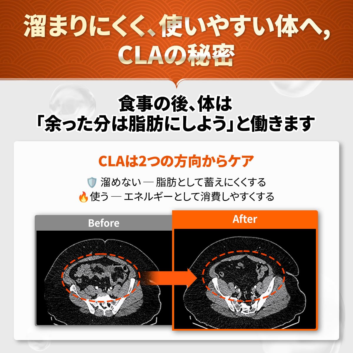 Amazon | DR.GET IT Kスリム CLA ダイエット サプリ 1400mg｜体脂肪