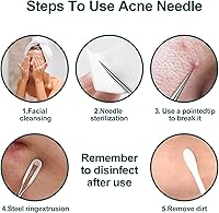 Vista 3 de Extractor de puntos negros, 3 piezas, herramienta para reventar espinillas, herramienta extractora de comedones para acné y manchas de espinillas