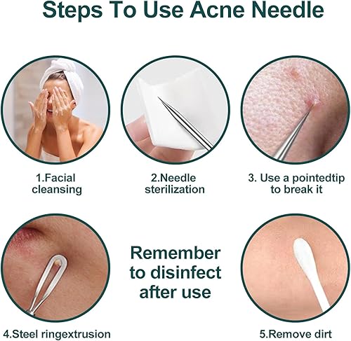 Miniatura 3 de Extractor de puntos negros, 3 piezas, herramienta para reventar espinillas, herramienta extractora de comedones para acné y manchas de espinillas,