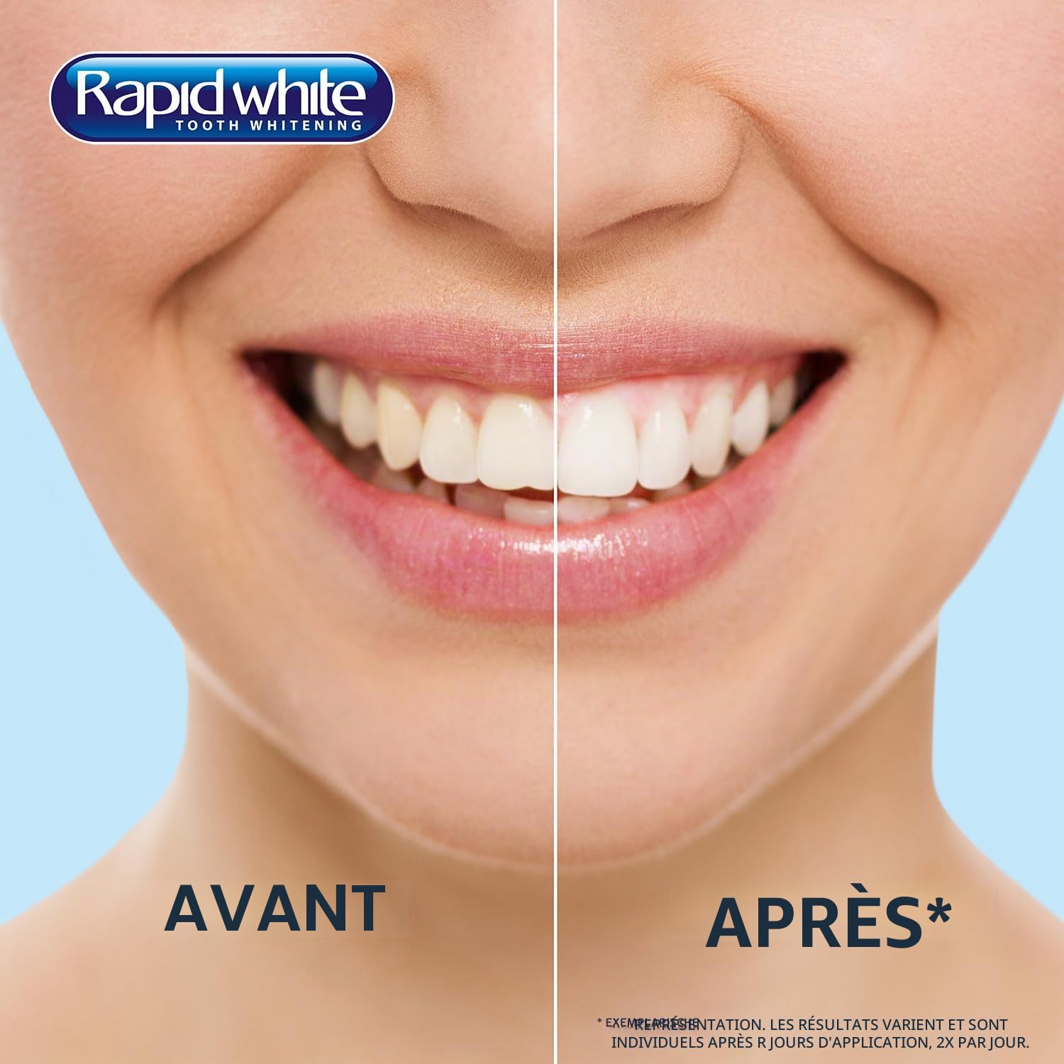 Rapid White Lot de 6 paquets de bandes blanchissantes pour des dents plus blanches en 3 jours - Blanchiment visible des dents pour la maison - Sans peroxyde d'hydrogène