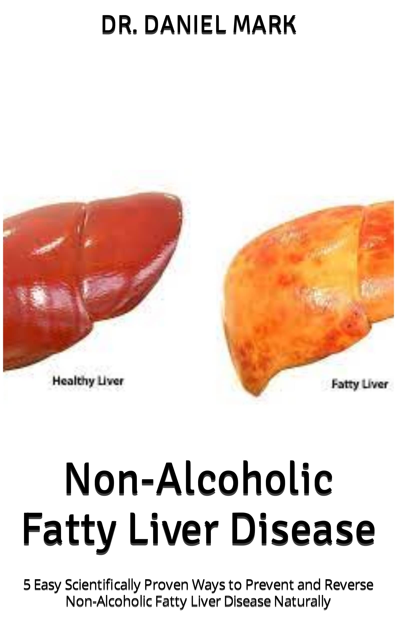 Reverse High Igg Naturally:  Proven Strategies For Better Health - mk2u0kw