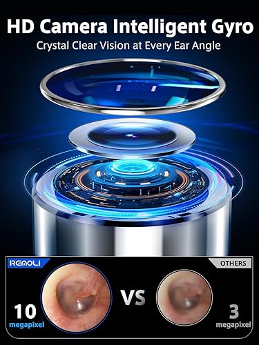 Miniatura 4 de Herramienta de eliminación de cera de oídos con video remoto en tiempo real, kit de eliminación de cera de oídos 3 en 1 con modo de púa y pinzas,