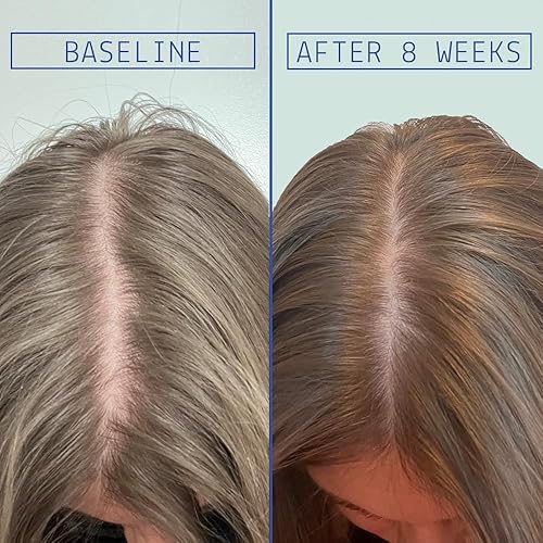 Miniatura 2 de AAVRANI Tratamiento para aumentar la densidad del cabello, Ashwagandha, colágeno vegano y suero de cúrcuma para cabello más grueso y lleno, vegano,