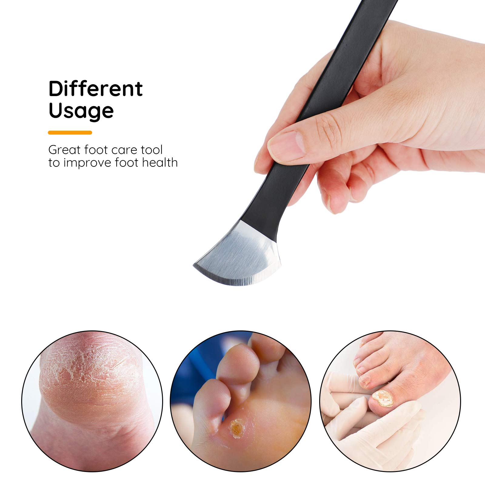 Juego de 4 cuchillos de pedicura para uñas encarnadas, pinzas de corrección con bolsa de transporte, acero de alto manganeso, cortador de reparación de pies para callos, salón de belleza, 2