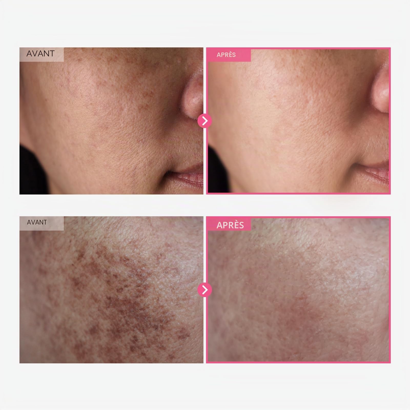 Duo Affinant le Teint K-Beauty TOSOWOONG : Crème Arbutine 7 Acide Tranexamique 4 et Sérum Pink Peptide 12 PDRN | Pour Teint & Texture Inégaux | Set Hydratant et Raffermissant
