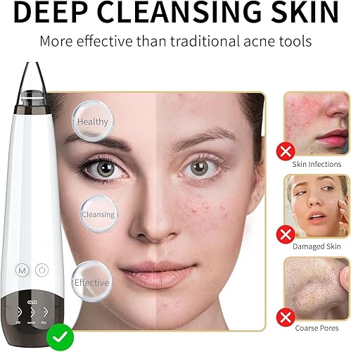 Miniatura 2 de Aspiradora de poros para eliminar puntos negros, limpiador facial de poros recargable visual, 3 succiones, 3 sondas, kit USB, herramienta eléctrica