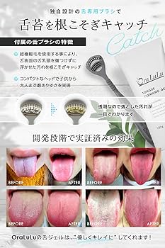 くりまりページ Amazon.co.jp: Cata-MEDICA 舌スクレーパー 口臭ケア 舌ブラシ