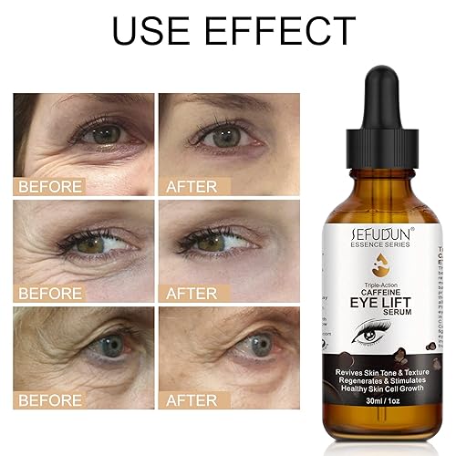 Miniatura 4 de Suero de ojos con cafeína, suero de elevación de ojos con cafeína para ojos hinchados y ojeras, crema de ojos con cafeína para bolsas hinchadas