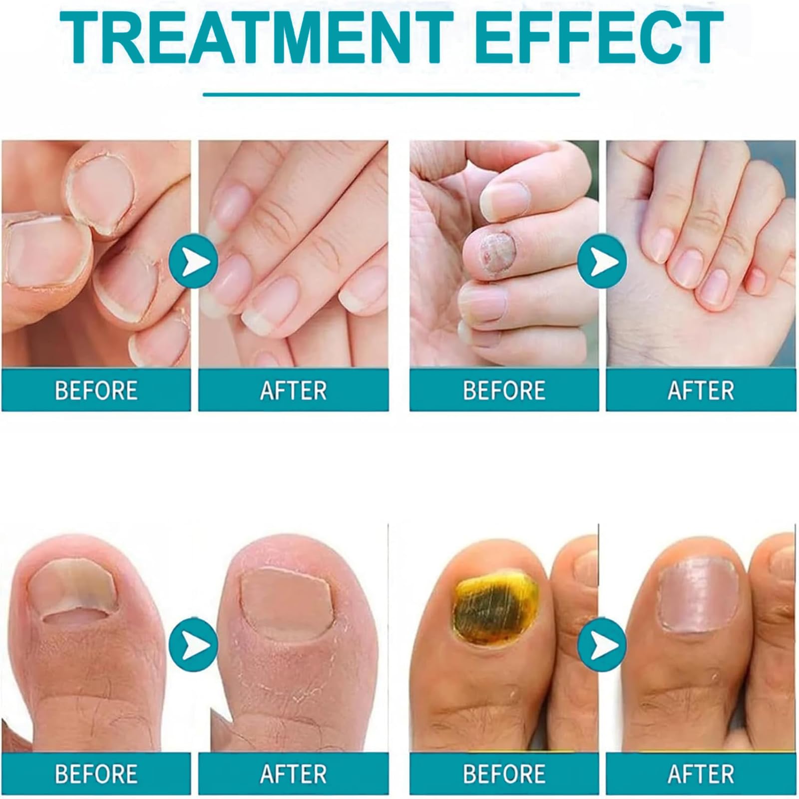 Penna per la cura delle unghie, illumina la superficie del rimuovi cuticole, olio 3 in 1 per unghie secche e danneggiate, amplificatore idratante per unghie sospese, portatile (14 pezzi)