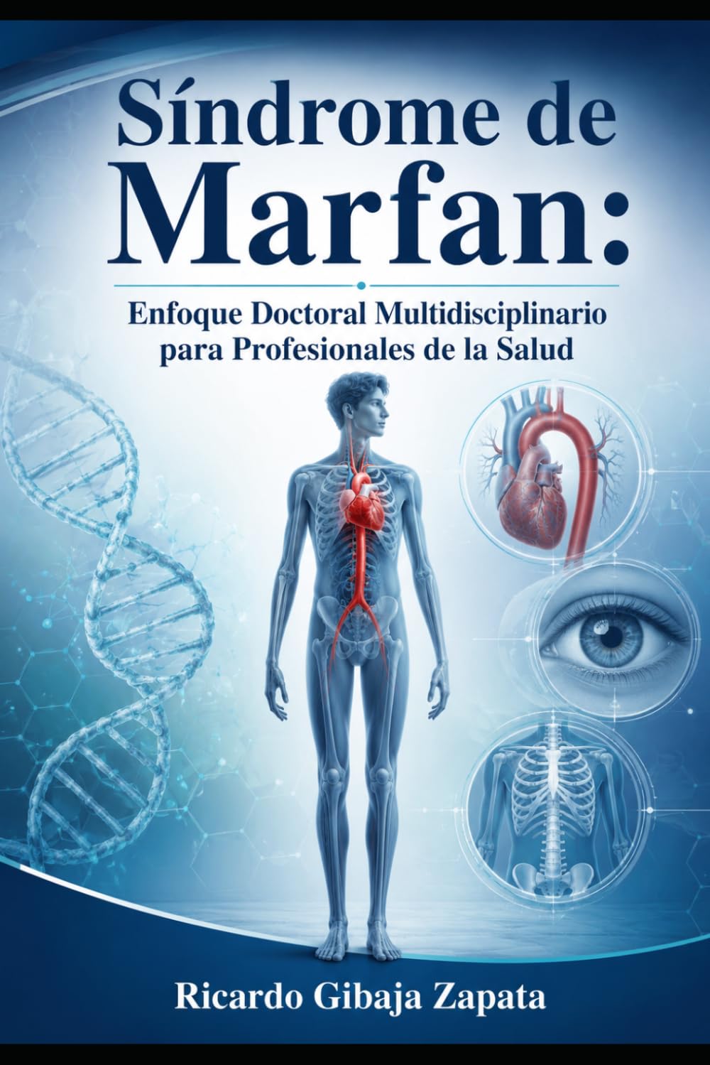 Síndrome de Marfan: Enfoque Doctoral Multidisciplinario para Profesionales de la Salud