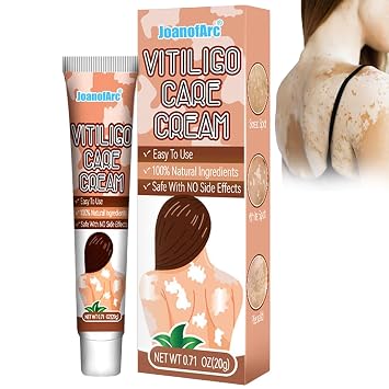 JoanofArc Natural Vitiligo Cream, 20g - Advanced Formula to target White Spots & Uneven Skin Tone, Promotes Melanin Production, Suitable for Men & Women