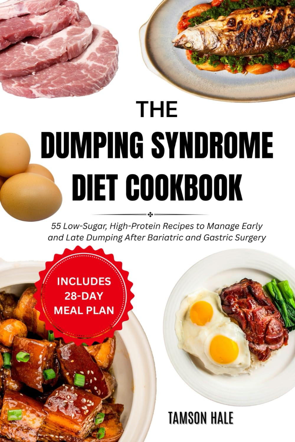 The Dumping Syndrome Diet Cookbook: 55 Low-Sugar, High-Protein Recipes to Manage Early and Late Dumping After Bariatric and Gastric Surgery