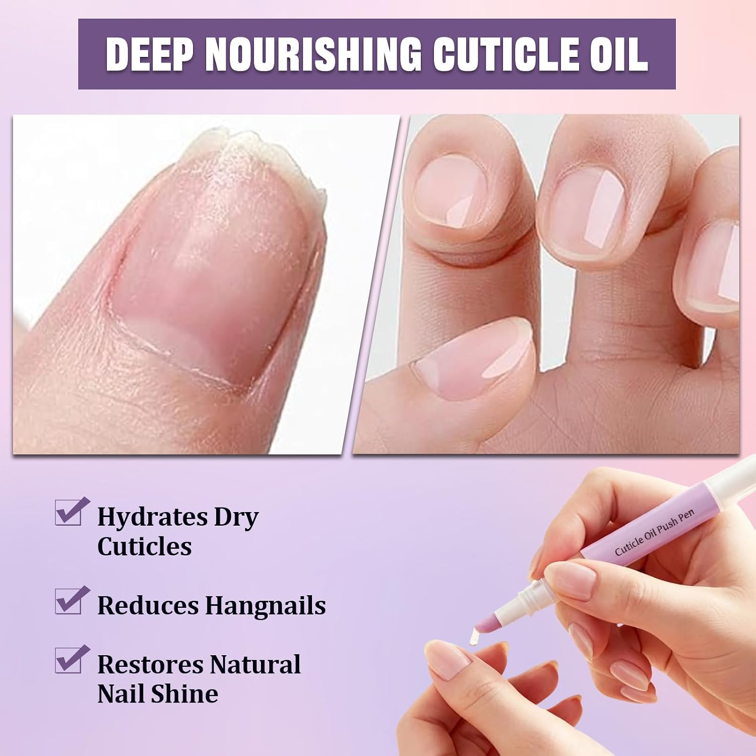 3Pcs 2-in-1 Cuticle Oil Pusher Pen,Ceramic Cuticle Pusher with Cuticle Nipper,Nail Care Tool Designed for Hangnails,Dry and Damaged Nails,Moisturizes,Strengthens and Brightens Nails