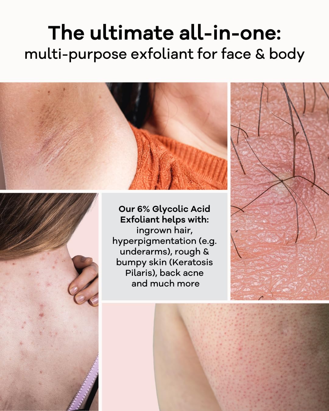 Skincerely Yours Fruchtsäure Peeling 100 ml I Mit 14% Fruchtsäuren und Grüntee Extrakt I Zellerneuernd I Gegen Pickel und Pigmentflecken I Anti-Aging Effekt I Vegan