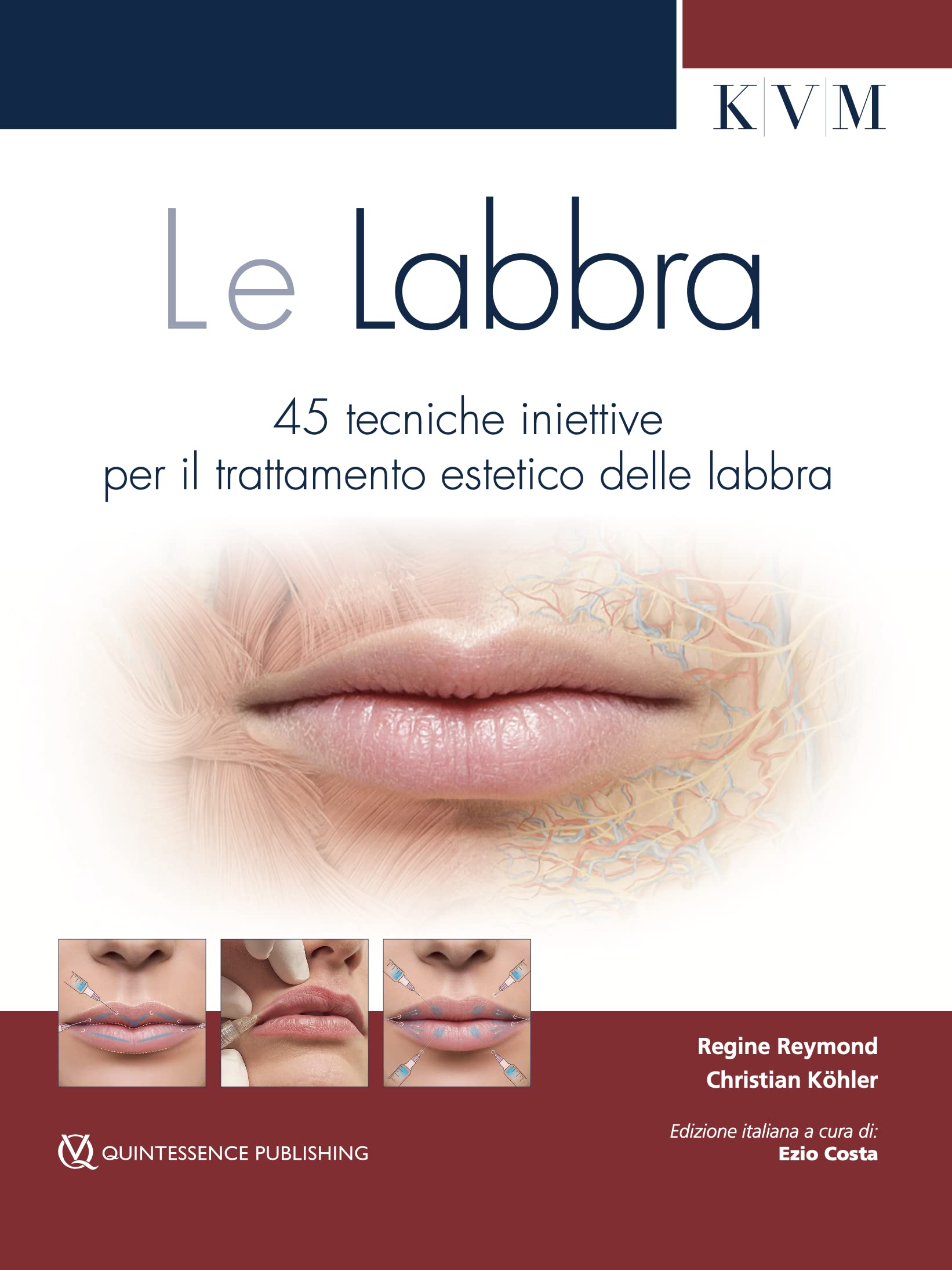 Le labbra. 45 tecniche iniettive per il trattamento estetico delle labbra