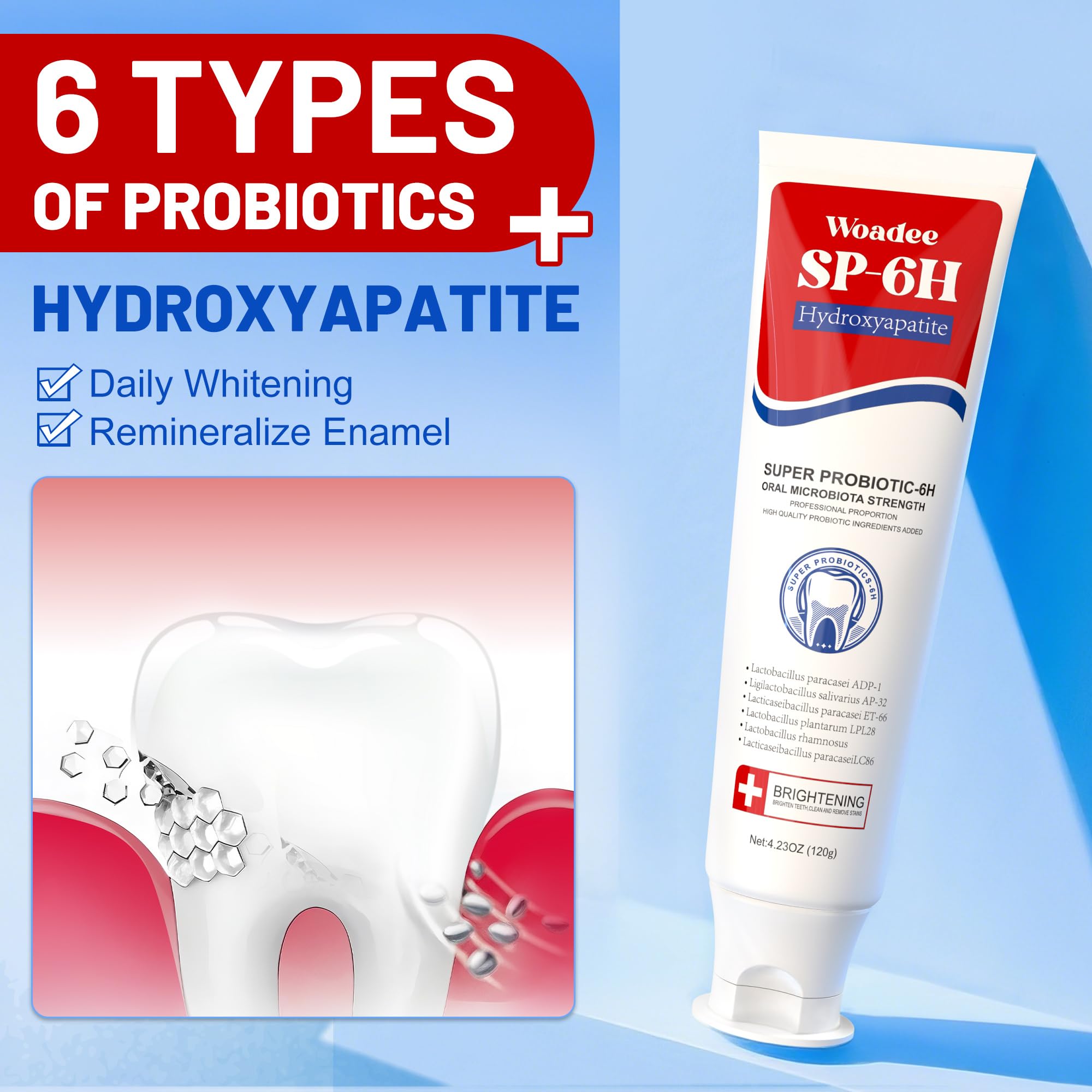 Amazon.com : SP-6 Toothpaste Set, 6 Probiotics for Whitening